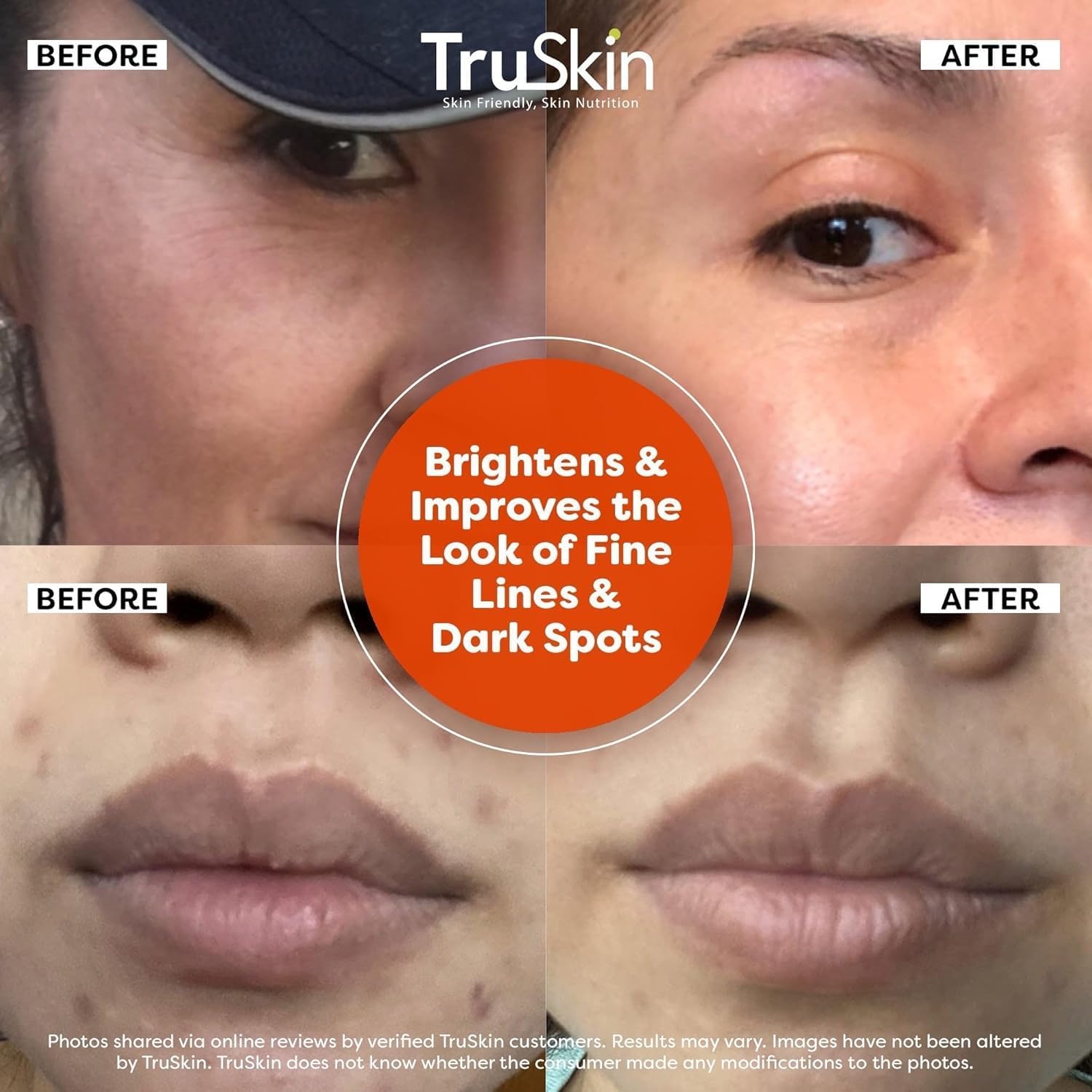 Truskin Vitamin C Facial Serum